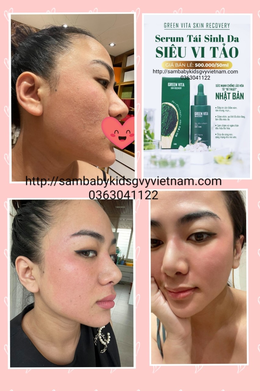 Serum tái sinh da siêu vi tảo Green Vita Serum tái sinh da siêu vi tảo Green Vita
