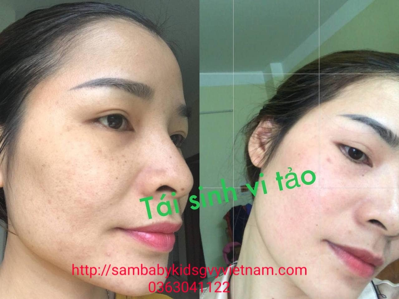 Serum tái tạo da green vita Serum tái tạo da green vita